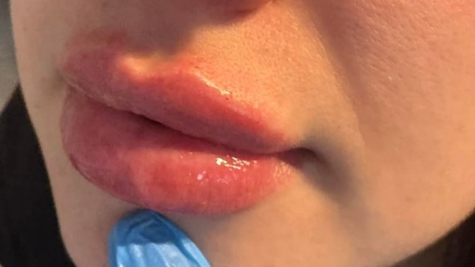 Mobility And Sports Massage