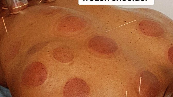 Mobility And Sports Massage