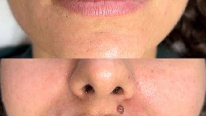 Mobility And Sports Massage